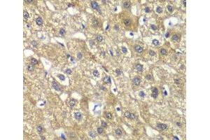 Immunohistochemistry of paraffin-embedded Human liver damage using MYBPC2 Polyclonal Antibody at dilution of 1:100 (40x lens). (MYBPC2 抗体)