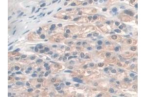 Immunohistochemistry (IHC) image for anti-Guanidinoacetate N-Methyltransferase (GAMT) (AA 2-236) antibody (ABIN7444211)
