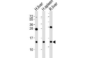 All lanes : Anti-CXCL11 Antibody at 1:2000 dilution Lane 1: human liver lysates Lane 2: human spleen lysates Lane 3: rat liver lysates Lysates/proteins at 20 μg per lane. (CXCL11 抗体)