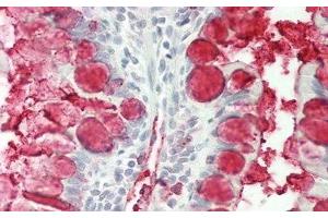 Immunohistochemistry (IHC) image for anti-Trefoil Factor 3 (Intestinal) (TFF3) (AA 22-80) antibody (ABIN7429229)