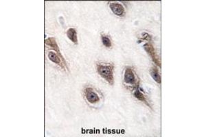 Formalin-fixed and paraffin-embedded human brain tissue reacted with GRB2 antibody (Center), which was peroxidase-conjugated to the secondary antibody, followed by DAB staining. (GRB2 抗体  (AA 89-118))