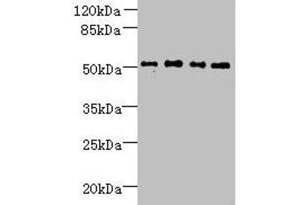 TTC38 抗体  (AA 2-200)
