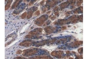 Immunohistochemistry (IHC) image for anti-Calcium/calmodulin-Dependent Protein Kinase II alpha (CAMK2A) (AA 1-478) antibody (ABIN7435484)