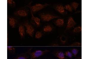 Immunofluorescence analysis of U-2 OS cells using PPP2CB Polyclonal Antibody at dilution of 1:100. (PPP2CB 抗体)