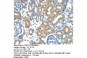 Rabbit Anti-APOBEC3D Antibody  Paraffin Embedded Tissue: Human Kidney Cellular Data: Epithelial cells of renal tubule Antibody Concentration: 4. (APOBEC3D 抗体  (N-Term))