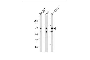 Western Blotting (WB) image for anti-Sema Domain, Transmembrane Domain (TM), and Cytoplasmic Domain, (Semaphorin) 6D (SEMA6D) (AA 19-48), (N-Term) antibody (ABIN1539136)