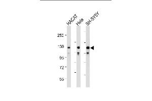 All lanes : Anti-SED Antibody (N-term) at 1:2000 dilution Lane 1: HACAT whole cell lysate Lane 2: Hela whole cell lysate Lane 3: SH-SY5Y whole cell lysate Lysates/proteins at 20 μg per lane. (SEMA6D 抗体  (N-Term))