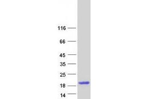 Western Blotting (WB) image for Defensin, alpha 5, Paneth Cell-Specific (DEFA5) protein (Myc-DYKDDDDK Tag) (ABIN2719350)