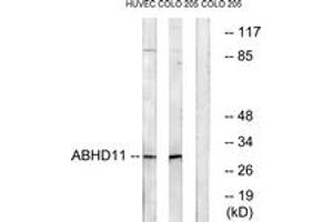 Western blot analysis of extracts from COLO/HuvEc cells, using ABHD11 Antibody. (ABHD11 抗体  (AA 161-210))