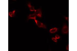 ABIN6274729 staining A549 by IF/ICC. (MRPL13 抗体  (C-Term))
