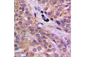 Immunohistochemistry (IHC) image for anti-Protein Kinase, AMP-Activated, alpha 1 Catalytic Subunit (PRKAA1) (C-Term), (pSer496) antibody (ABIN7299402)