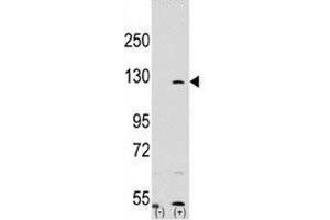 Western blot analysis of PARP antibody and 293 cell lysate (2 ug/lane) either nontransfected (Lane 1) or transiently transfected with the PARP1 gene (2). (PARP1 抗体  (AA 183-214))