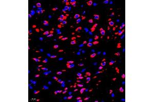 Immunofluorescence of paraffin embedded rat brain using P4H (ABIN7074215) at dilution of 1:700 (400x lens) (HIF Prolyl Hydroxylase 抗体)