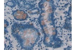 Immunohistochemistry (IHC) image for anti-Intelectin 1 (Galactofuranose Binding) (ITLN1) (AA 31-253) antibody (ABIN7432898)