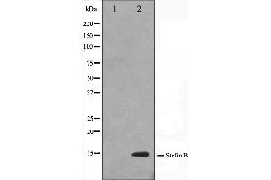 Western blot analysis on A549 cell lysate using CSTB Antibody,The lane on the left is treated with the antigen-specific peptide. (CSTB 抗体  (C-Term))