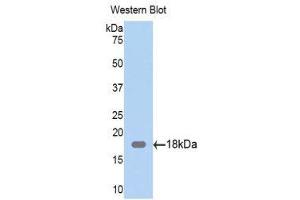 Western Blotting (WB) image for anti-Zyxin (ZYX) (AA 377-523) antibody (ABIN1860974) (ZYX 抗体  (AA 377-523))