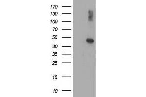 Western Blotting (WB) image for anti-Adaptor-Related Protein Complex 2, mu 1 Subunit (AP2M1) (AA 97-383) antibody (ABIN1491720) (AP2M1 抗体  (AA 97-383))
