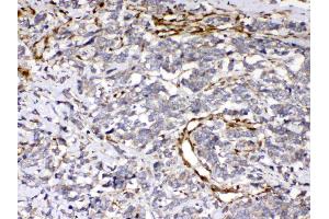 IHC analysis of Cytoglobin using anti- Cytoglobin antibody . (CYGB 抗体  (AA 1-190))