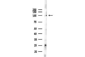 Western blot analysis of lysates from LoVo cells(heat-shock,45 min treatment), using LONP1 Antibody at 1/1000 dilution.