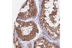 Immunohistochemical staining of human testis with FABP12 polyclonal antibody  shows strong cytoplasmic positivity in cells of seminiferus ducts at 1:10-1:20 dilution.