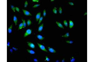 Immunofluorescent analysis of Hela cells using ABIN7163192 at dilution of 1:100 and Alexa Fluor 488-congugated AffiniPure Goat Anti-Rabbit IgG(H+L) (PIK3CB 抗体  (Catalytic Subunit beta))