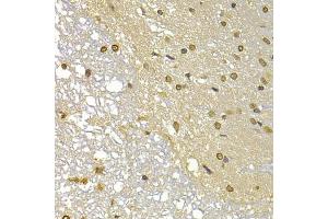 Immunohistochemistry of paraffin-embedded rat brain using S100A4 antibody (ABIN5970801) at dilution of 1/100 (40x lens). (s100a4 抗体)