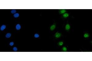 IF analysis of ASF1B using anti-ASF1B antibody (ABIN7599074).