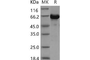 Western Blotting (WB) image for V-Akt Murine Thymoma Viral Oncogene Homolog 3 (Protein Kinase B, Gamma) (AKT3) (AA 106-479) protein (GST tag,His tag) (ABIN7198632)