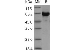 Western Blotting (WB) image for V-Akt Murine Thymoma Viral Oncogene Homolog 3 (Protein Kinase B, Gamma) (AKT3) (AA 106-479) protein (GST tag,His tag) (ABIN7198632) (AKT3 Protein (AA 106-479) (GST tag,His tag))