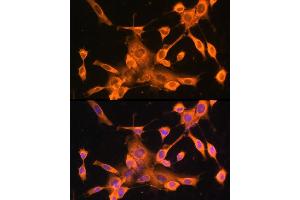 Immunofluorescence analysis of NIH-3T3 cells using FOXO3A Rabbit pAb (ABIN6129381, ABIN6140755, ABIN6140756 and ABIN6213618) at dilution of 100 (40x lens). (FOXO3 抗体  (AA 394-672))