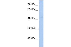 WB Suggested Anti-TFDP3 Antibody Titration:  0. (TFDP3 抗体  (Middle Region))
