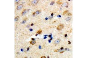 Immunohistochemical analysis of PLC beta 3 staining in human brain formalin fixed paraffin embedded tissue section. (PLCB3 抗体  (C-Term))