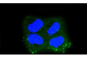 HeLa cells were fixed in paraformaldehyde, permeabilized with 0. (Keratin 10 抗体)