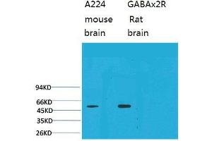 Western Blot (WB) analysis of 1) Mouse Brain Tissue, 2)Rat Brain Tissue with GABA A Receptor alpha2 Rabbit Polyclonal Antibody diluted at 1:2000. (GABRA2 抗体)