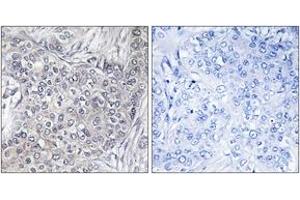 Immunohistochemistry (IHC) image for anti-Eukaryotic Translation Initiation Factor 4E Binding Protein 1 (EIF4EBP1) (AA 13-62), (pThr46) antibody (ABIN1531764)