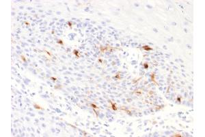 Recombinant Tyrosinase-Related Protein 1 抗体  (AA 257-377)