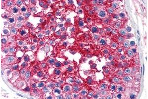 Human Testis (formalin-fixed, paraffin-embedded) stained with BSG antibody ABIN239809 at 10 ug/ml followed by biotinylated anti-mouse IgG secondary antibody ABIN481714, alkaline phosphatase-streptavidin and chromogen. (CD147 抗体)