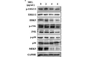 MEL exerts an effect on the MAPK pathway, as determined through qRT-PCR and Western blotting in UM-UC-3 and 5637 cells. (ERK1 抗体  (pThr185, pThr187, pThr202, pThr204))