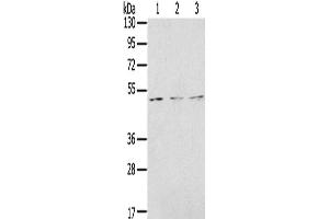 Western Blotting (WB) image for anti-Forkhead Box G1 (FOXG1) antibody (ABIN2431349) (FOXG1 抗体)