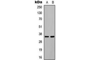 Western blot analysis of C/EBP beta (pT235) expression in HEK293T EGF-treated (A), COLO205 EGF-treated (B) whole cell lysates. (CEBPB 抗体  (pSer235))