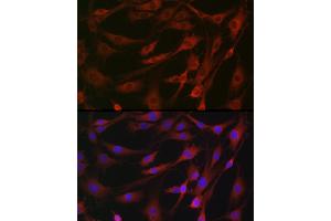 Immunofluorescence analysis of NIH/3T3 cells using MLKL Rabbit pAb (ABIN7268669) at dilution of 1:100 (40x lens). (MLKL 抗体)