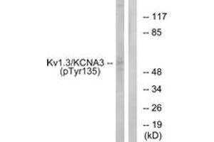 Western Blotting (WB) image for anti-Potassium Voltage-Gated Channel, Shaker-Related Subfamily, Member 3 (KCNA3) (AA 101-150), (pTyr135) antibody (ABIN1531682)