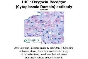 Image no. 1 for anti-Oxytocin Receptor (OXTR) (3rd Cytoplasmic Domain) antibody (ABIN1737737) (Oxytocin Receptor 抗体  (3rd Cytoplasmic Domain))