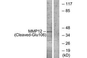 Western blot analysis of extracts from NIH-3T3 cells, treated with etoposide 25uM 1h, using MMP12 (Cleaved-Glu106) Antibody. (MMP12 抗体  (Cleaved-Glu106))