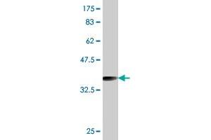 Western Blot detection against Immunogen (36. (RAB27A 抗体  (AA 122-221))