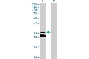Western Blot analysis of GJB5 expression in transfected 293T cell line by GJB5 MaxPab polyclonal antibody.