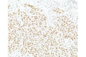 Immunohistochemistry (IHC) image for anti-SWI/SNF Related, Matrix Associated, Actin Dependent Regulator of Chromatin, Subfamily E, Member 1 (SMARCE1) (C-Term) antibody (ABIN7795731)