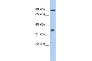 WB Suggested Anti-C6orf154 Antibody Titration: 0. (C6orf154 抗体  (Middle Region))