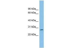 C1orf104 antibody used at 1 ug/ml to detect target protein. (C1orf104 抗体  (Middle Region))