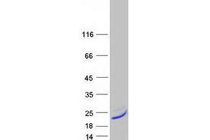 Western Blotting (WB) image for Gastric Inhibitory Polypeptide (GIP) protein (Myc-DYKDDDDK Tag) (ABIN2721711)